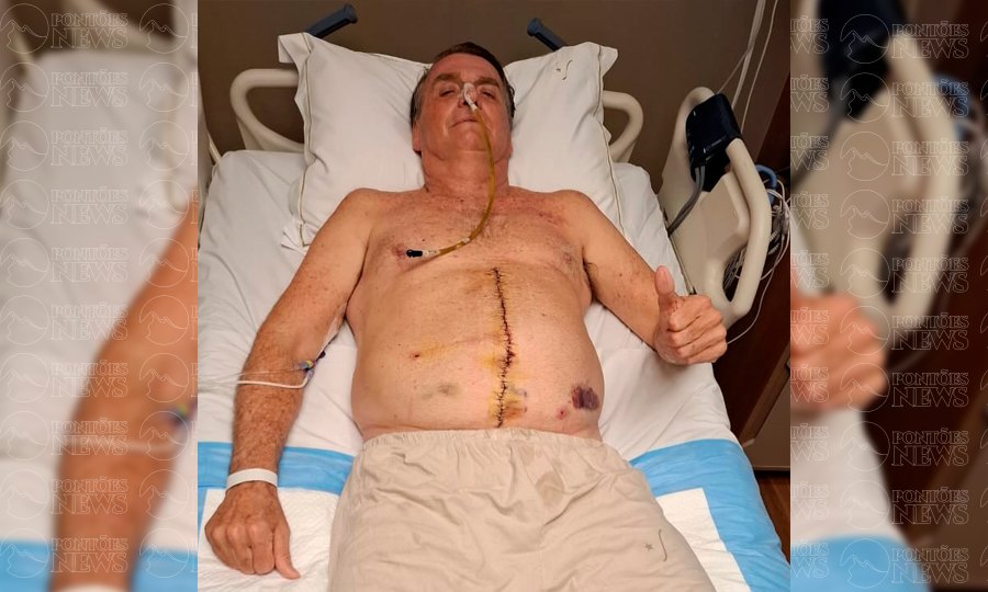 Bolsonaro segue internado na UTI e apresenta primeiros sinais de recuperação intestinal após cirurgia